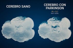 Reclaman el reconocimiento del párkinson como enfermedad profesional agrícola